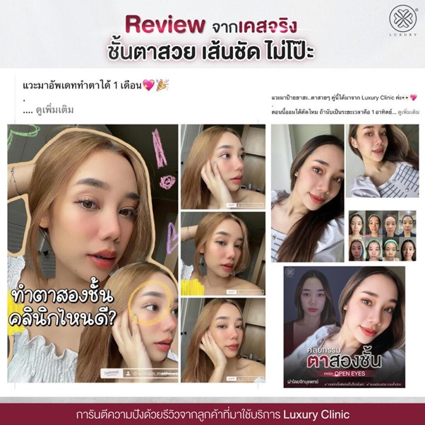 Reviewจากเคสจริง