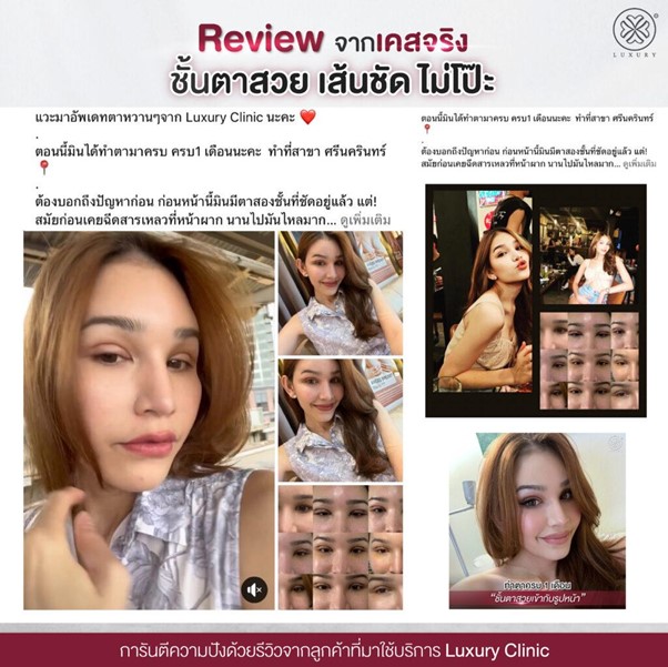 Reviewจากเคสจริง