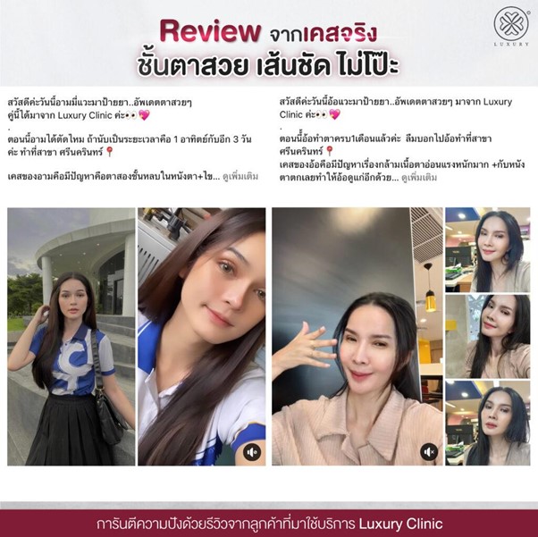 Reviewจากเคสจริง