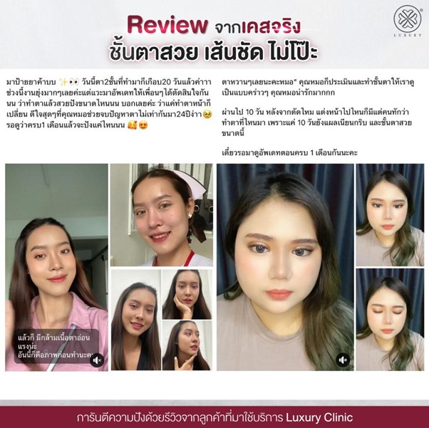 Reviewจากเคสจริง