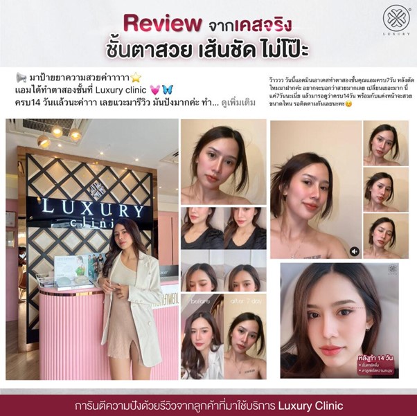 Reviewจากเคสจริง