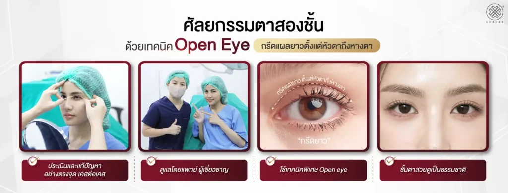 เทคนิค open eyes ตาสองชั้น luxury clinic