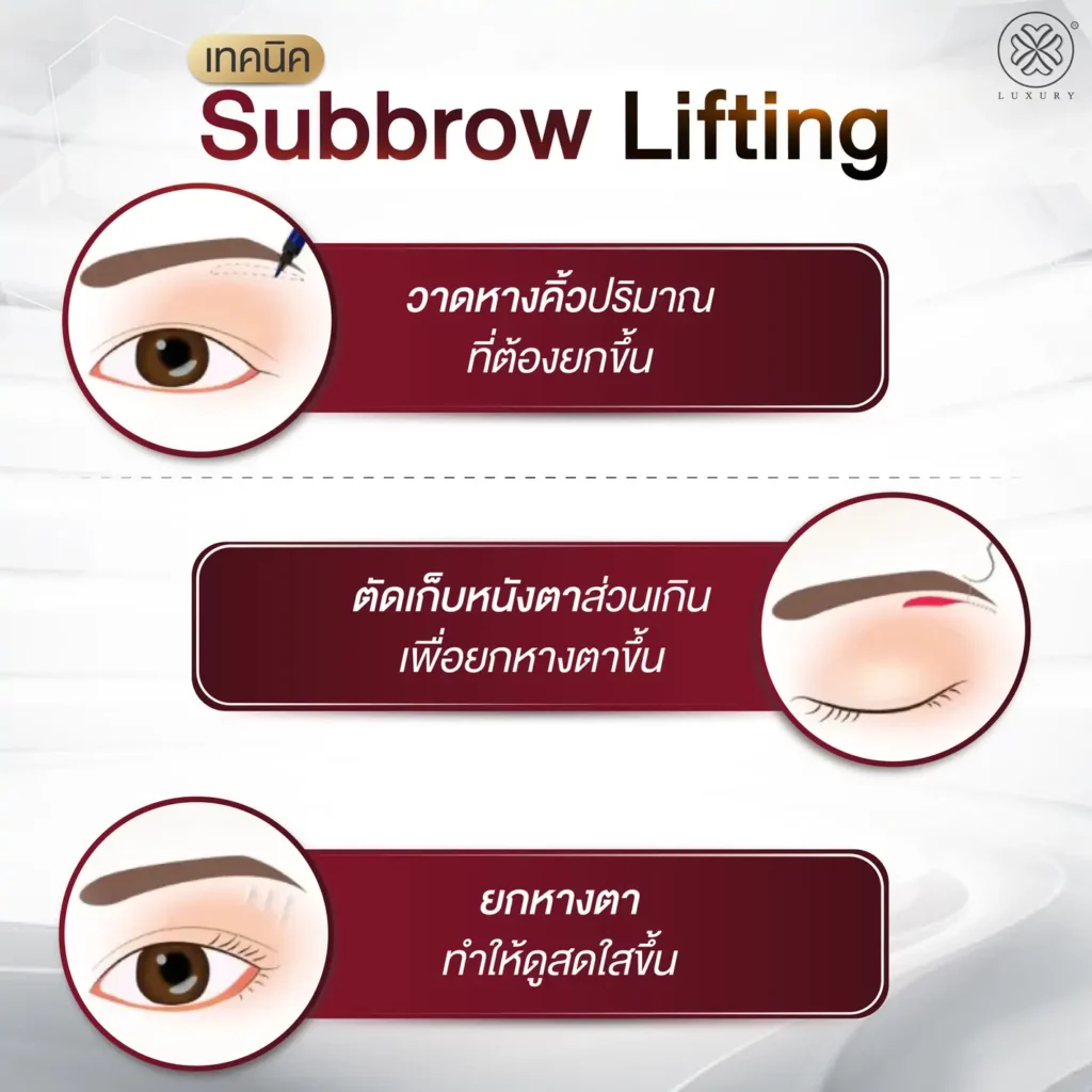 subbrow lifting luxury clinic