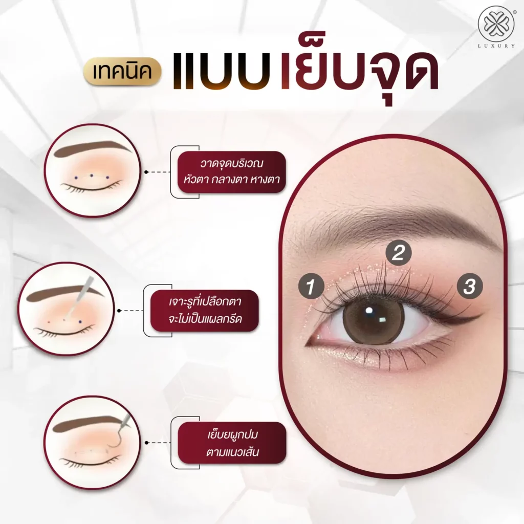 เทคนิคแบบเย็บจุด ตาสองชั้น luxury clinic