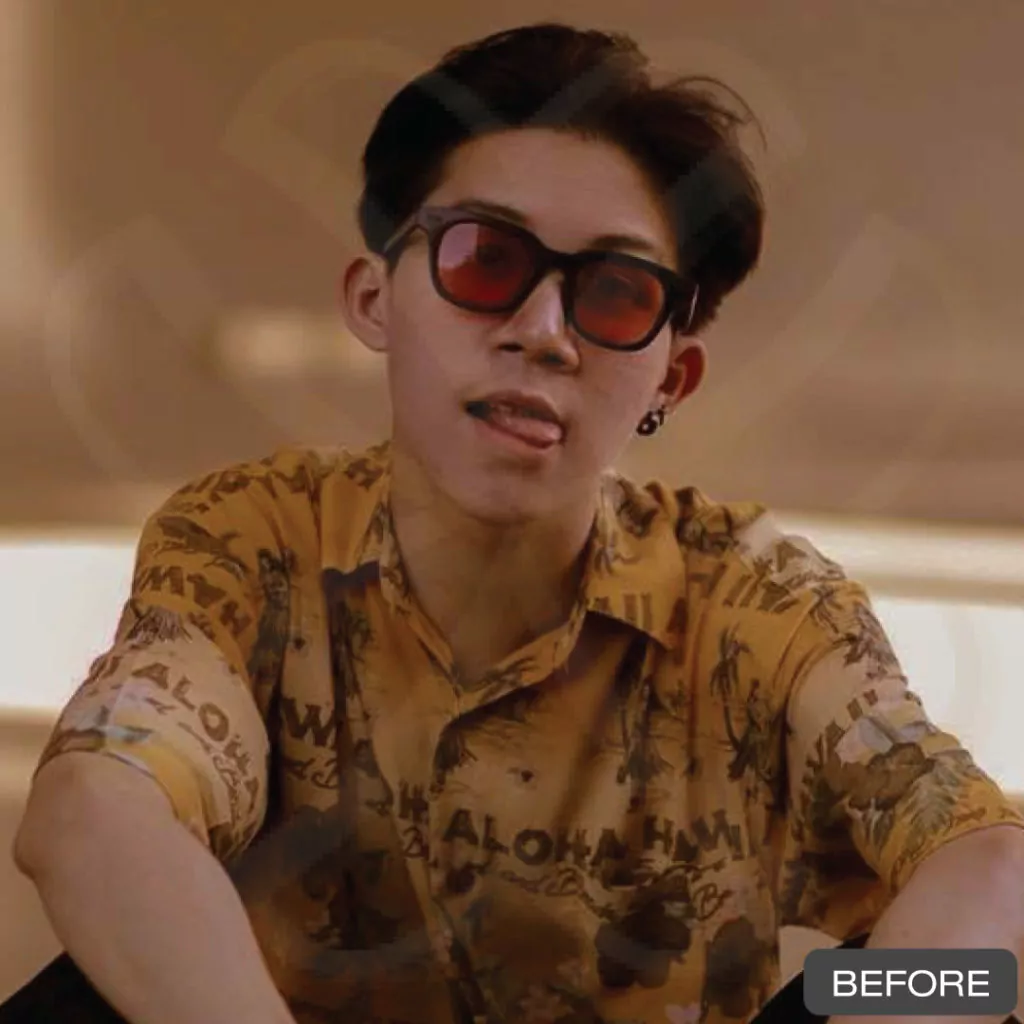 หูกาง ทำให้สูญเสียความมั่นใจ