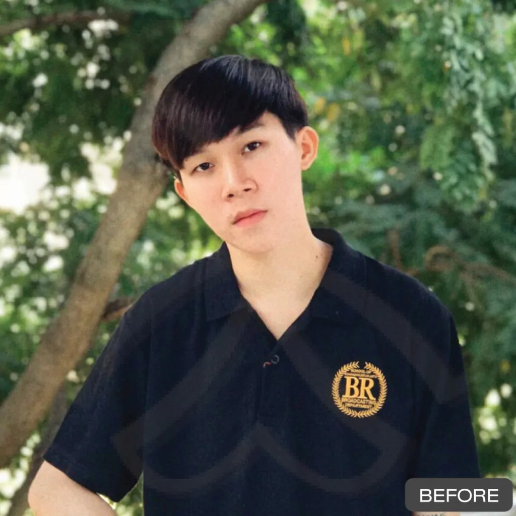 หูกาง ทำให้สูญเสียความมั่นใจ