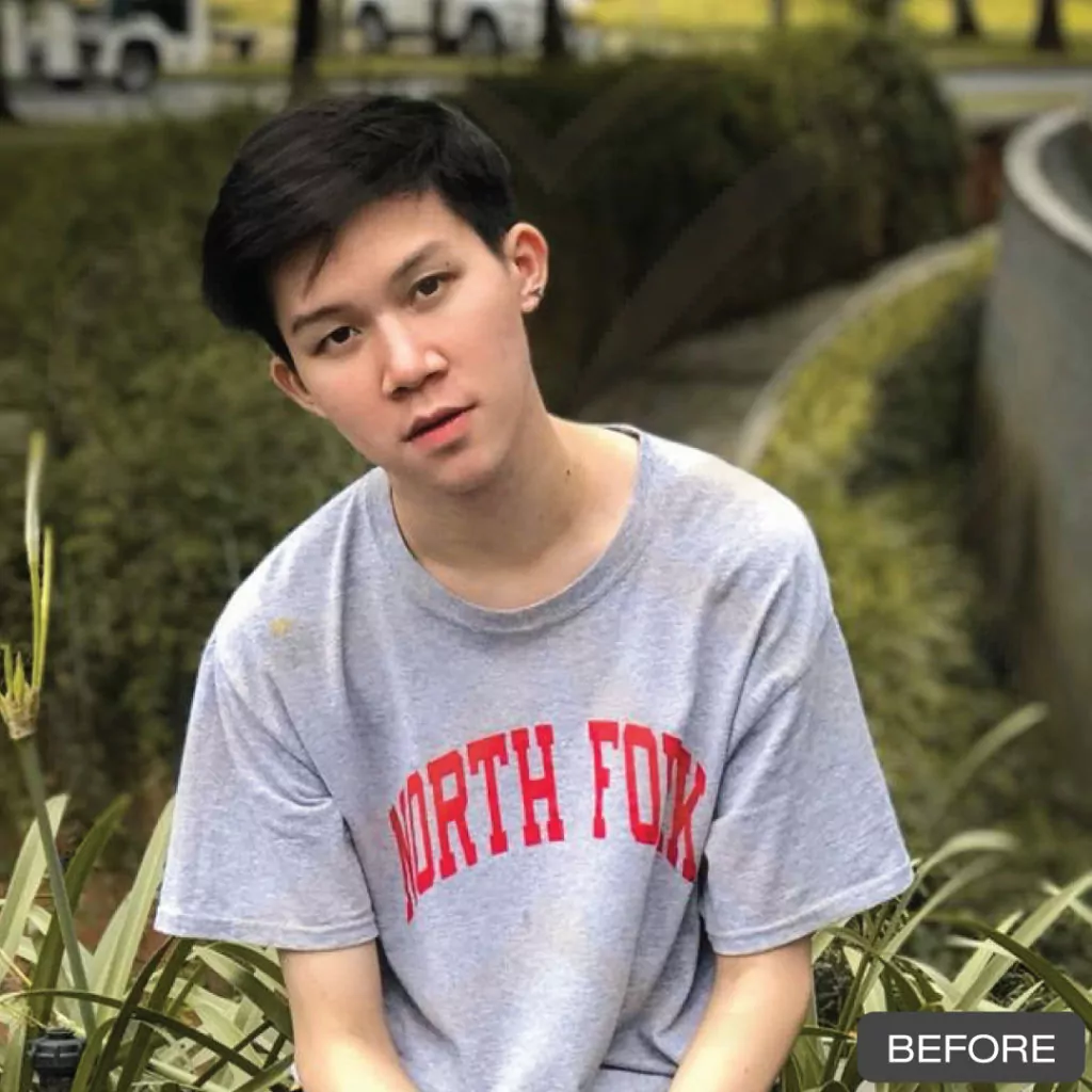 หูกาง ทำให้สูญเสียความมั่นใจ