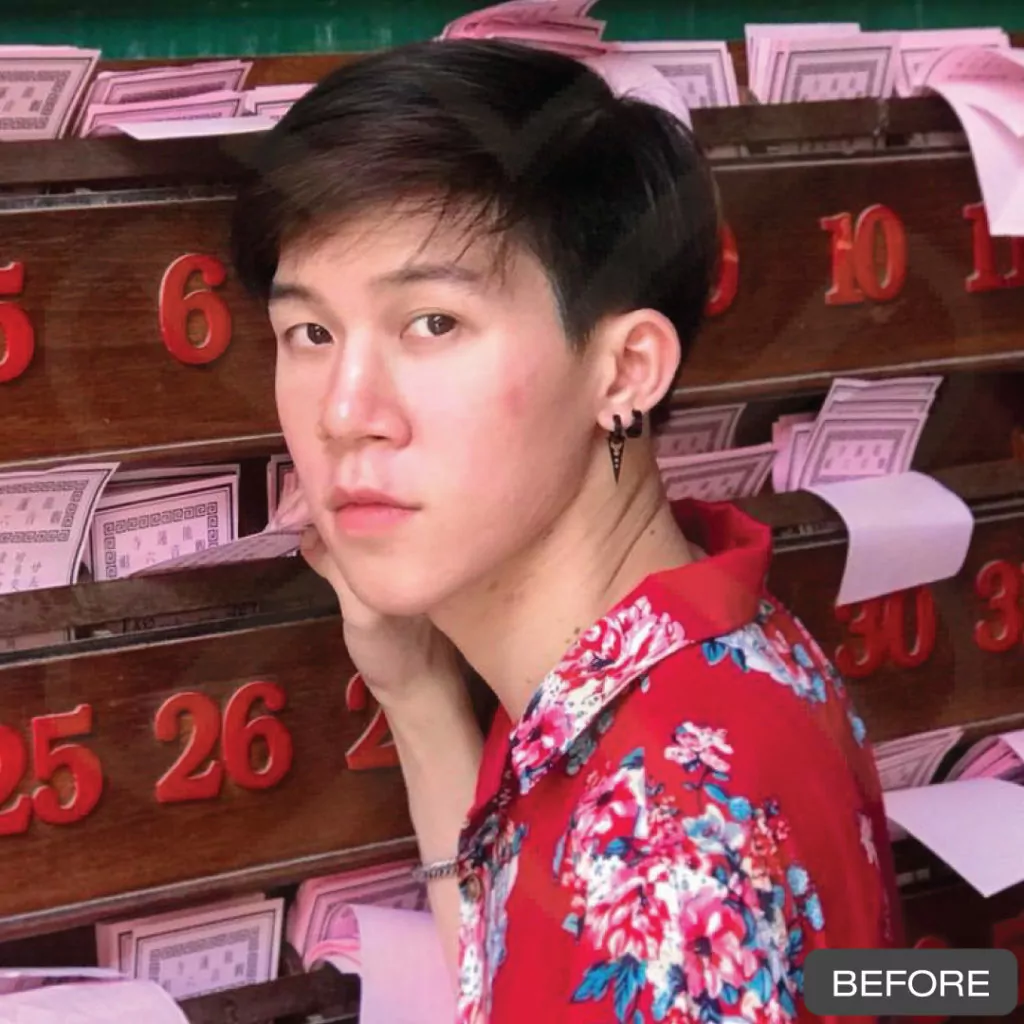 หูกาง ทำให้สูญเสียความมั่นใจ