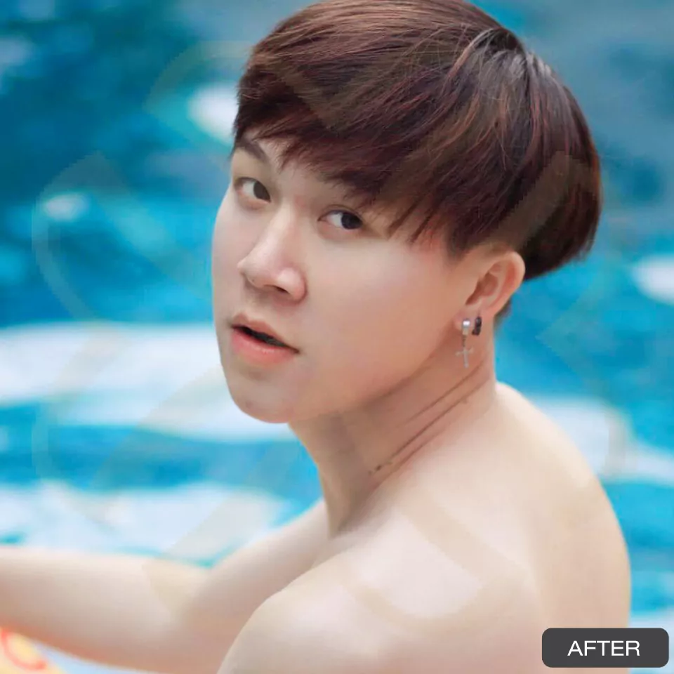 หูกาง ทำให้สูญเสียความมั่นใจ