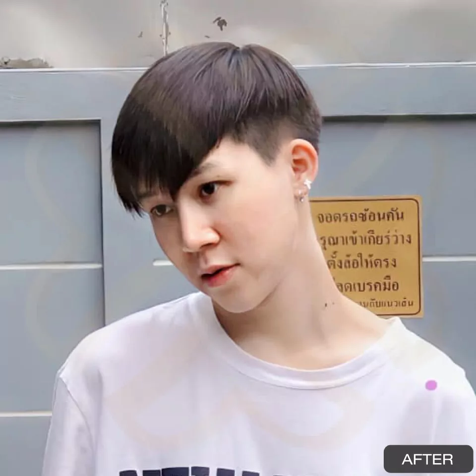 หูกาง ทำให้สูญเสียความมั่นใจ