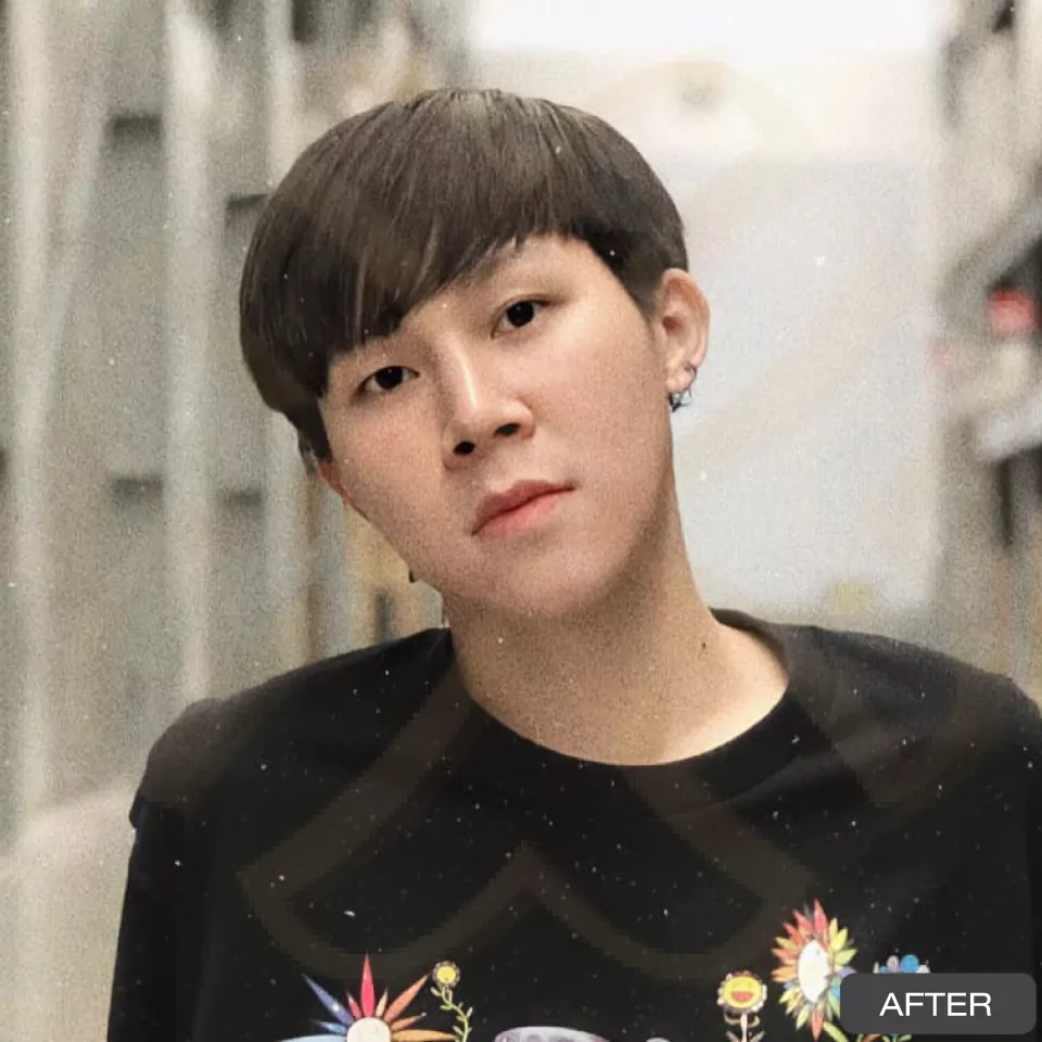 หูกาง ทำให้สูญเสียความมั่นใจ