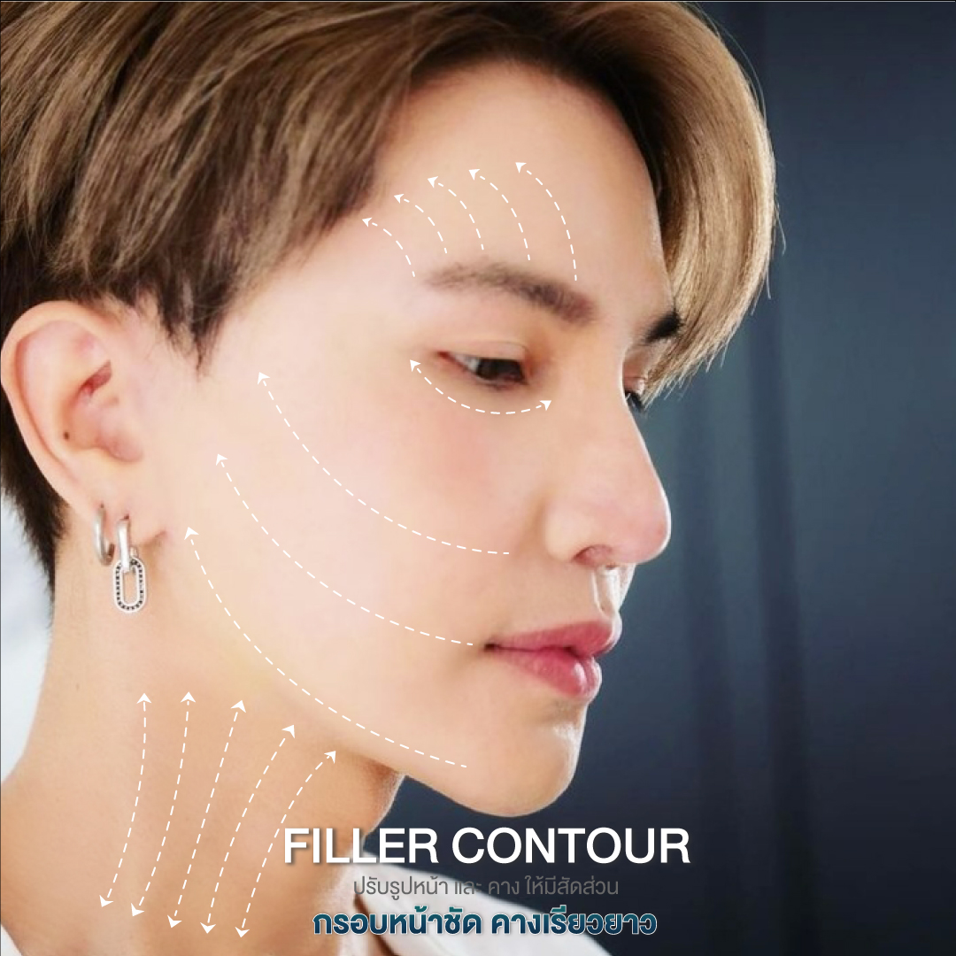 filler contour