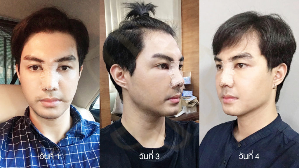 วันที่ 1-3-4