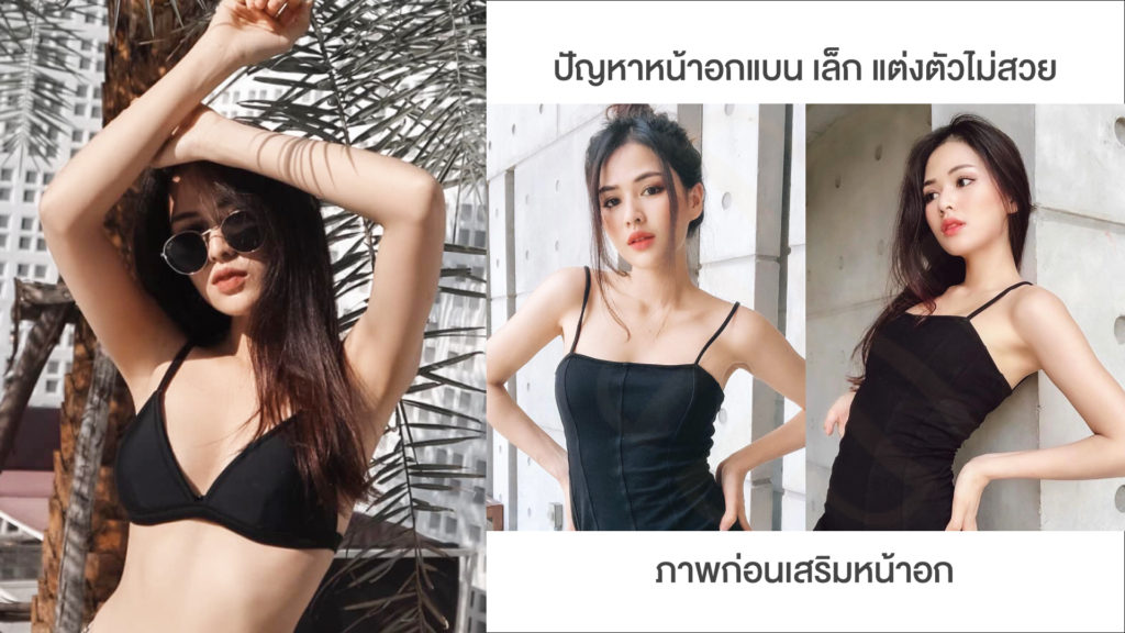 ปัญหาหน้าอกก่อนทำ luxury clinic