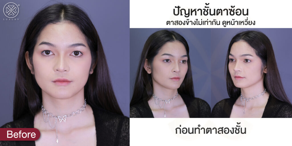 ทำตาสองชั้น