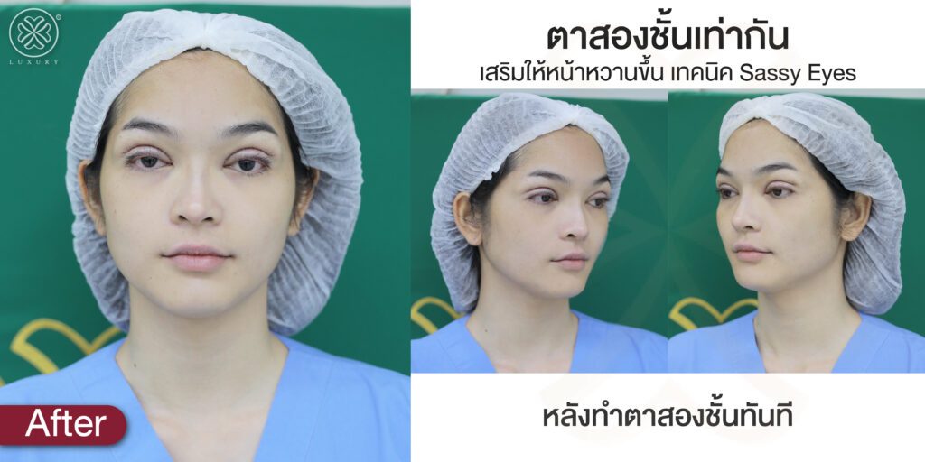 ทำตาสองชั้น