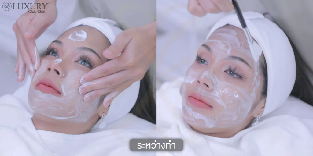 รักษาฝ้า แก้ฝ้า ซ่อมแซมเซลล์