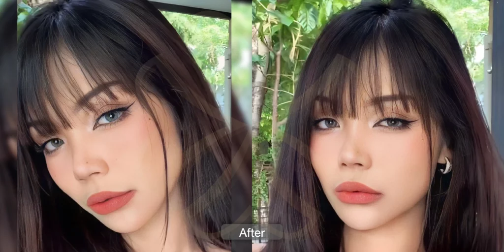 รีวิวรักษาฝ้า