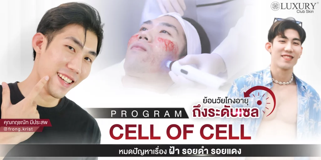 รีวิวเซลล์รักษาฝ้า รักษาฝ้า
