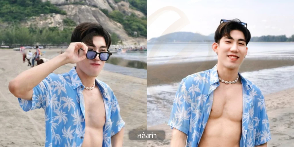 รีวิวเซลล์รักษาฝ้า รักษาฝ้า