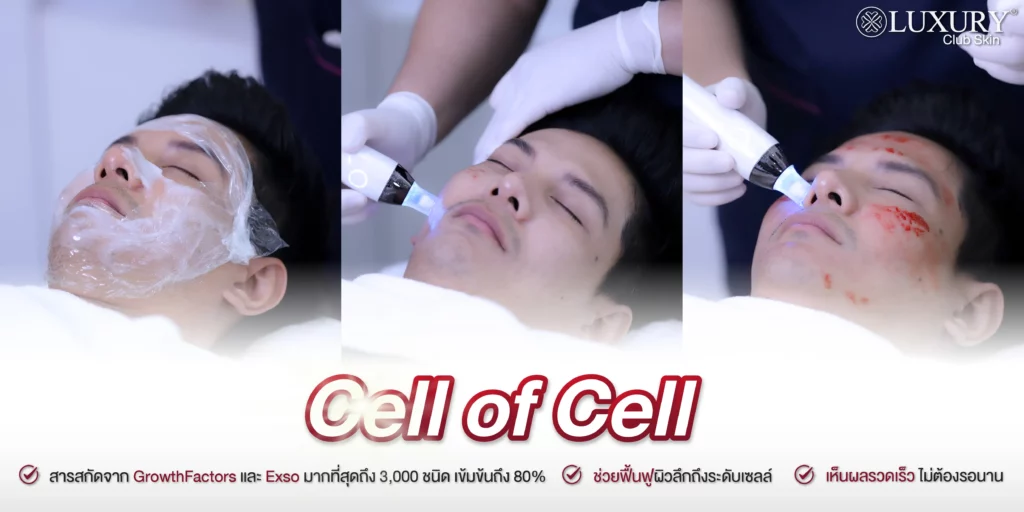รักษาฝ้า