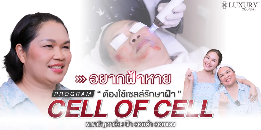 แก้ฝ้า รักษาฝ้า กำจัดฝ้า รีวิวรักษาฝ้า
