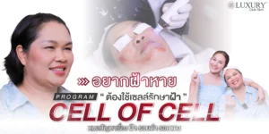 แก้ฝ้า รักษาฝ้า กำจัดฝ้า รีวิวรักษาฝ้า