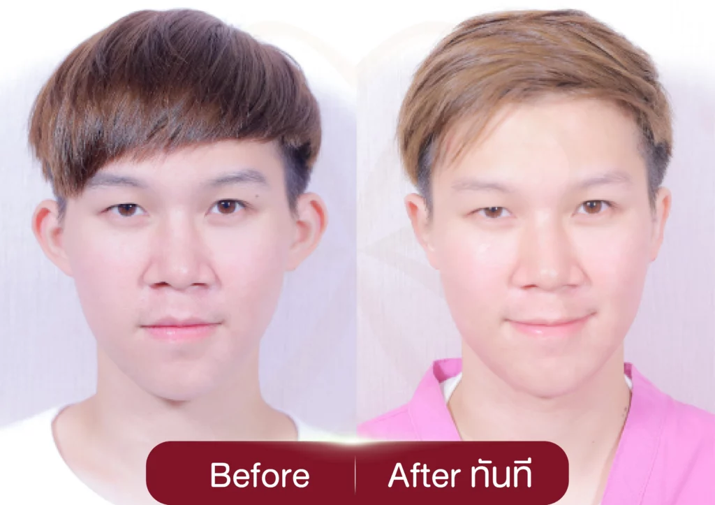 รีวิวหูกาง