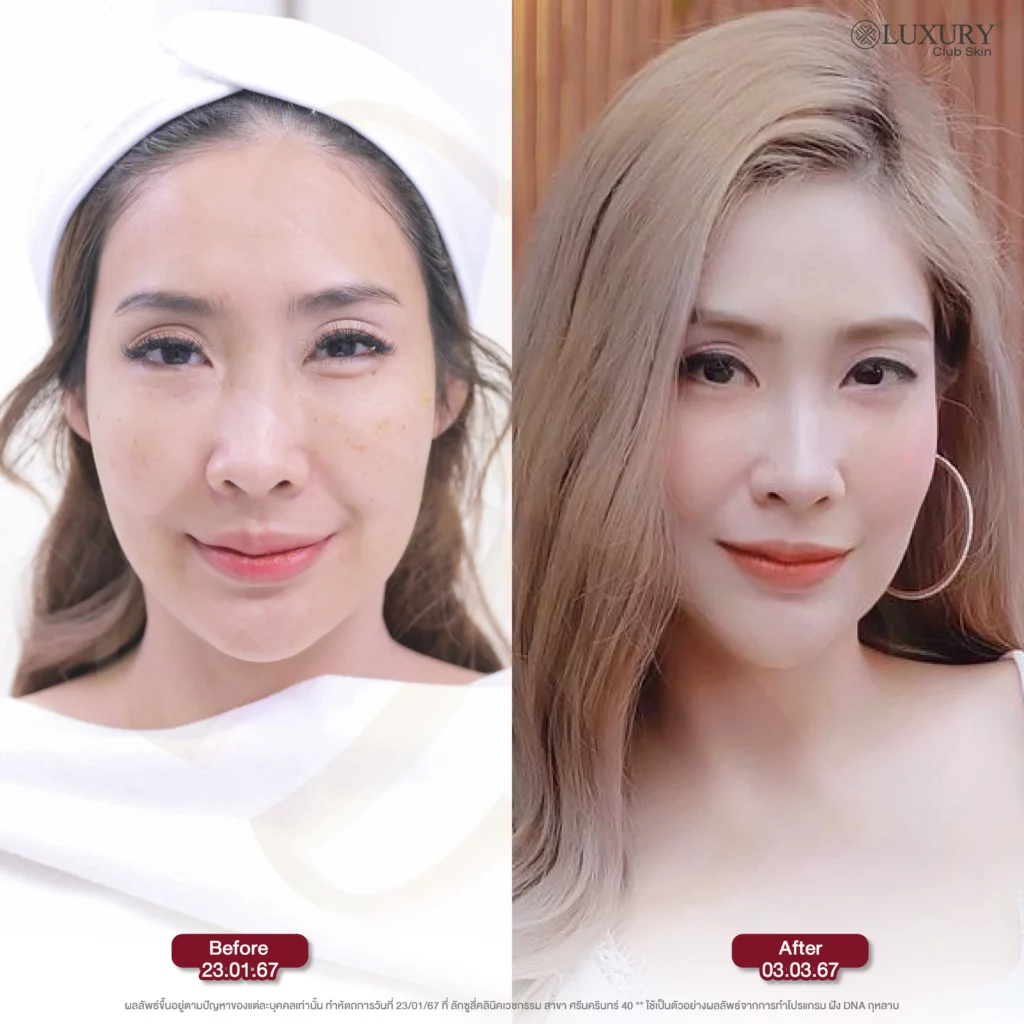 ก่อน-หลัง โปรแกรมฝัง DNA กุหลาบ
