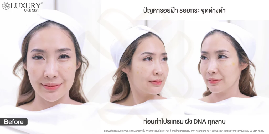 โปรแกรมฝัง DNA กุหลาบ