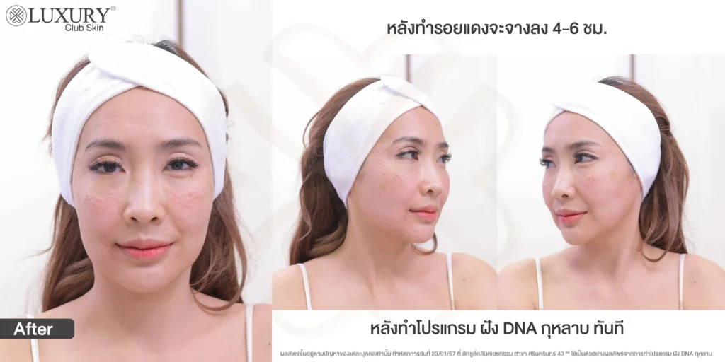 โปรแกรมฝัง DNA กุหลาบ