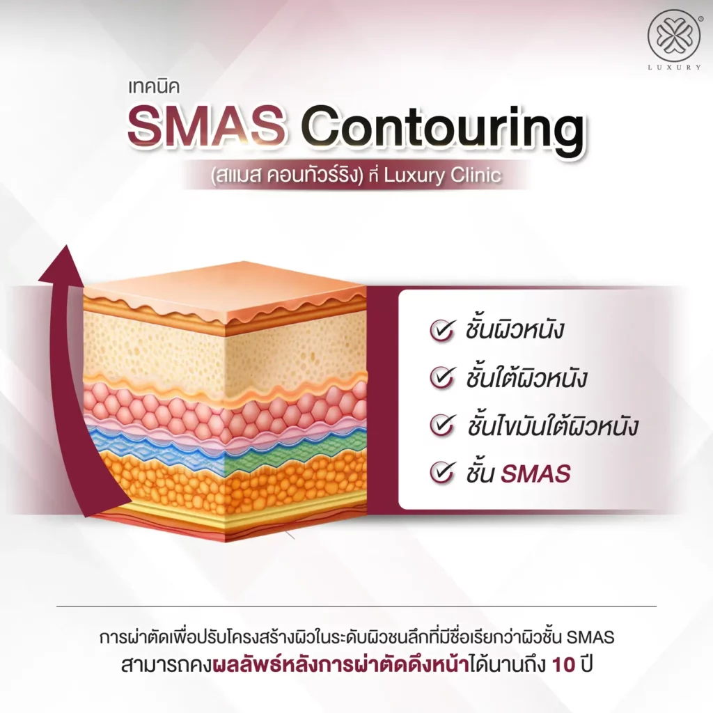 เทคนิค smas contouring คืออะไร