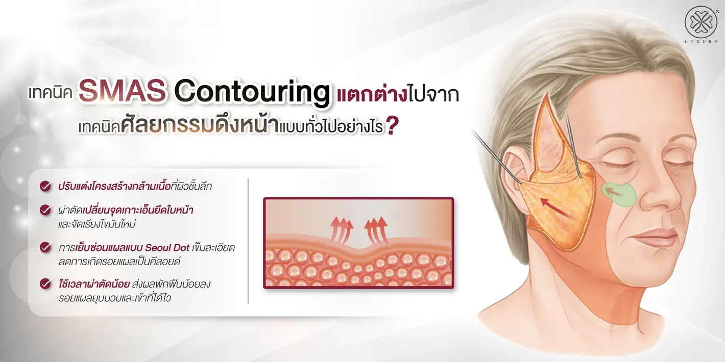 smas contouring แตกต่างจากเทคนิคทั่วไปอย่างไร