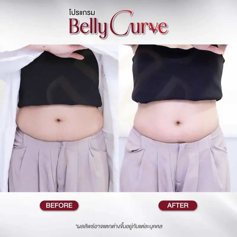 belly curve before-after