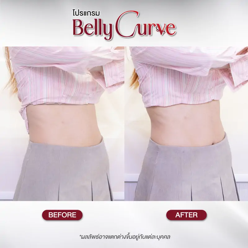 belly curve before-after