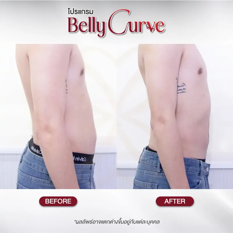 belly curve before-after