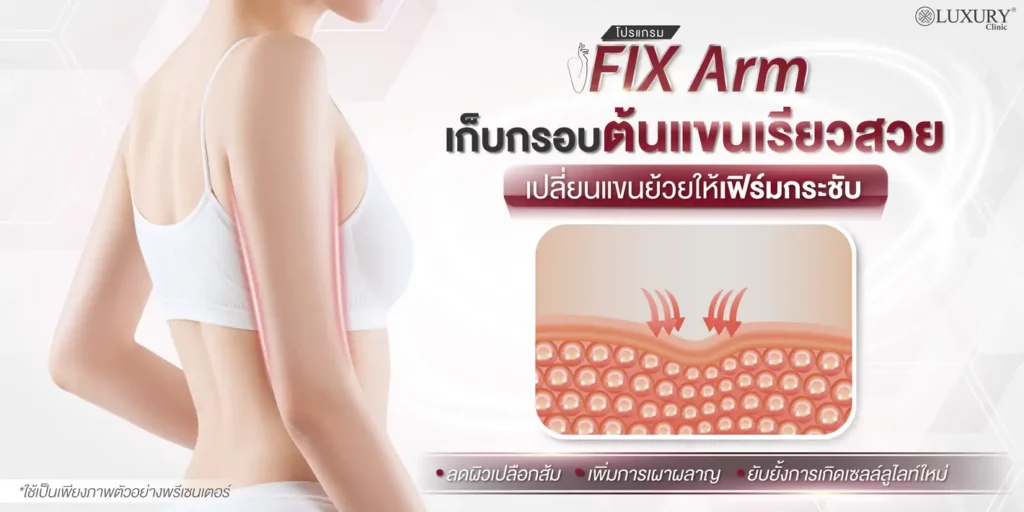 Fix Arm