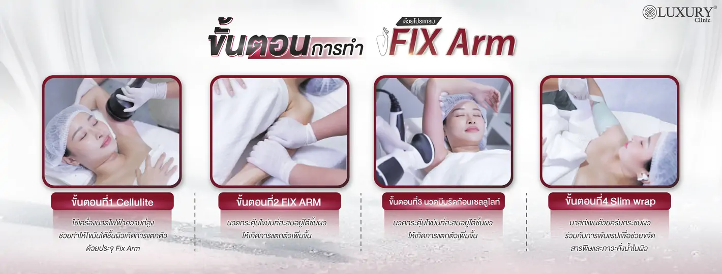 ขั้นตอนการทำ Fix Arm