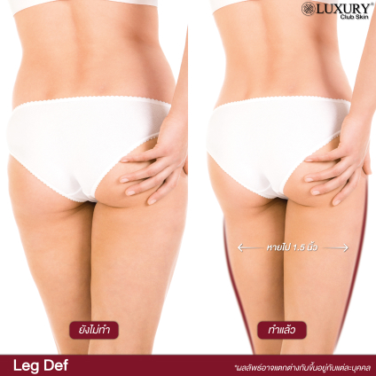 legdef before after