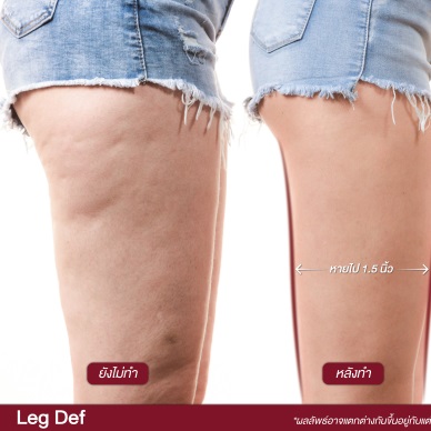 legdef before after
