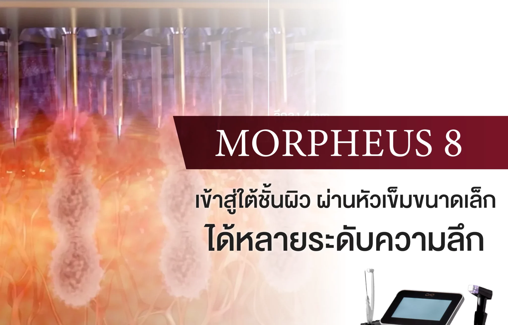 Morppheus 8