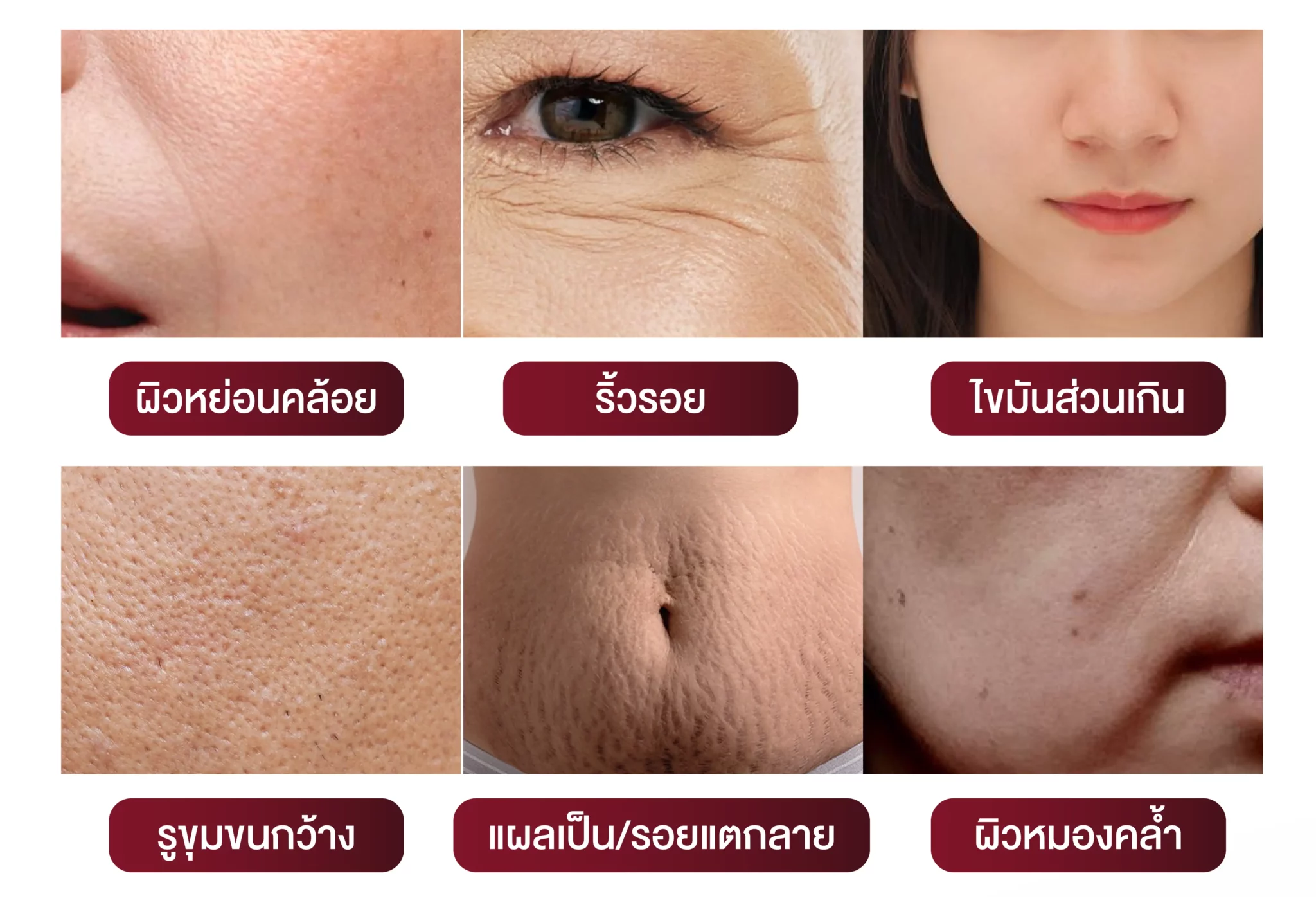 Morppheus 8 เหมาะสำหรับแก้ปัญหาเรื่องใดบ้าง