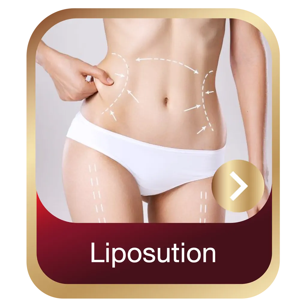 liposuction