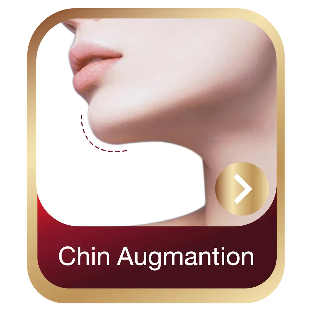 chin augmantion