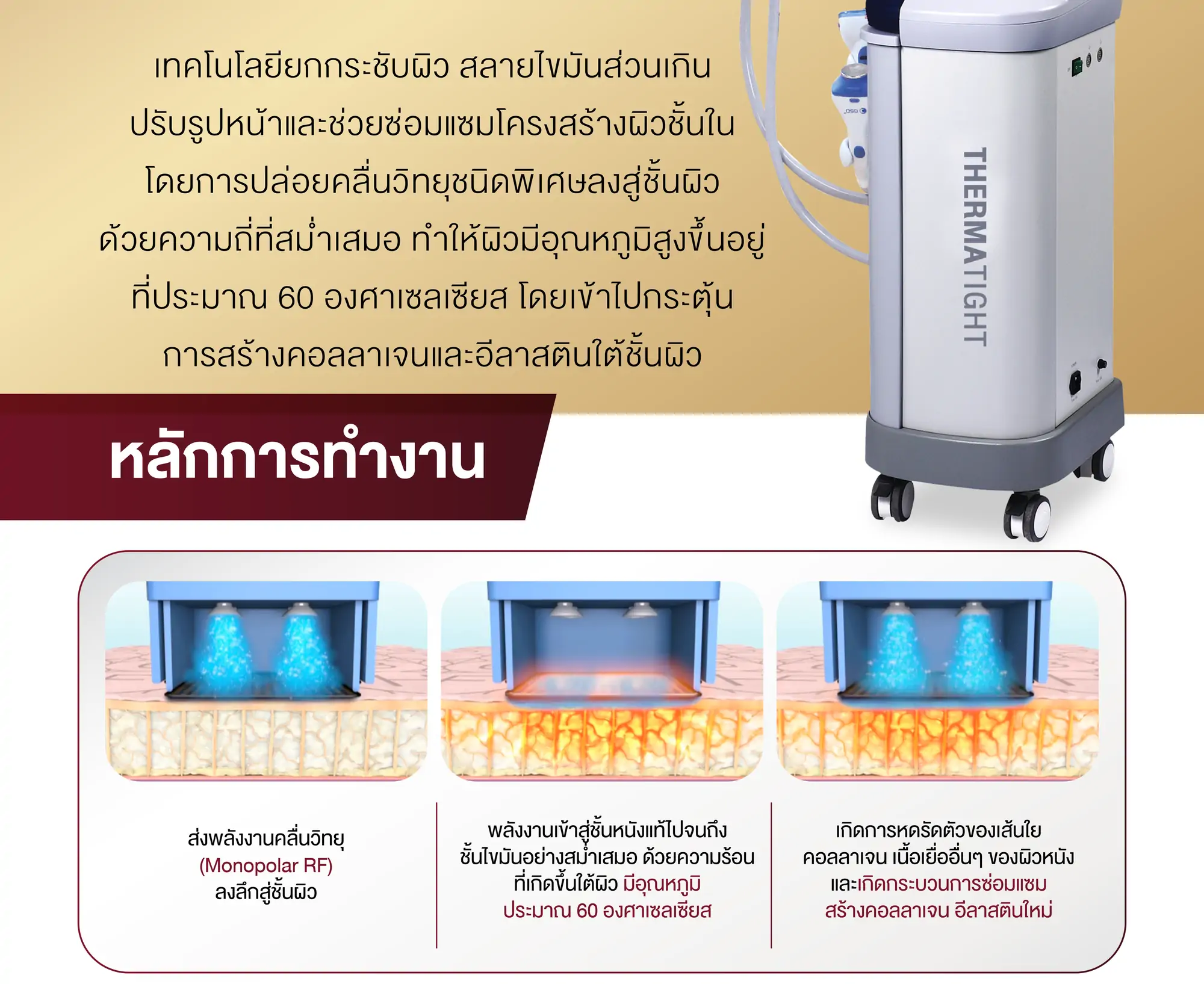 หลักการทำงาน thermatight
