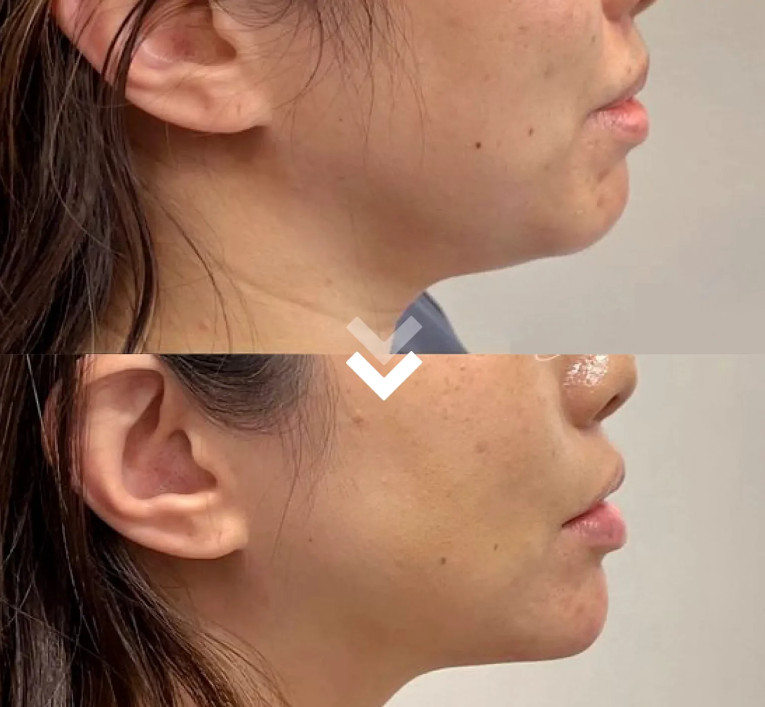รีวิว thermatight