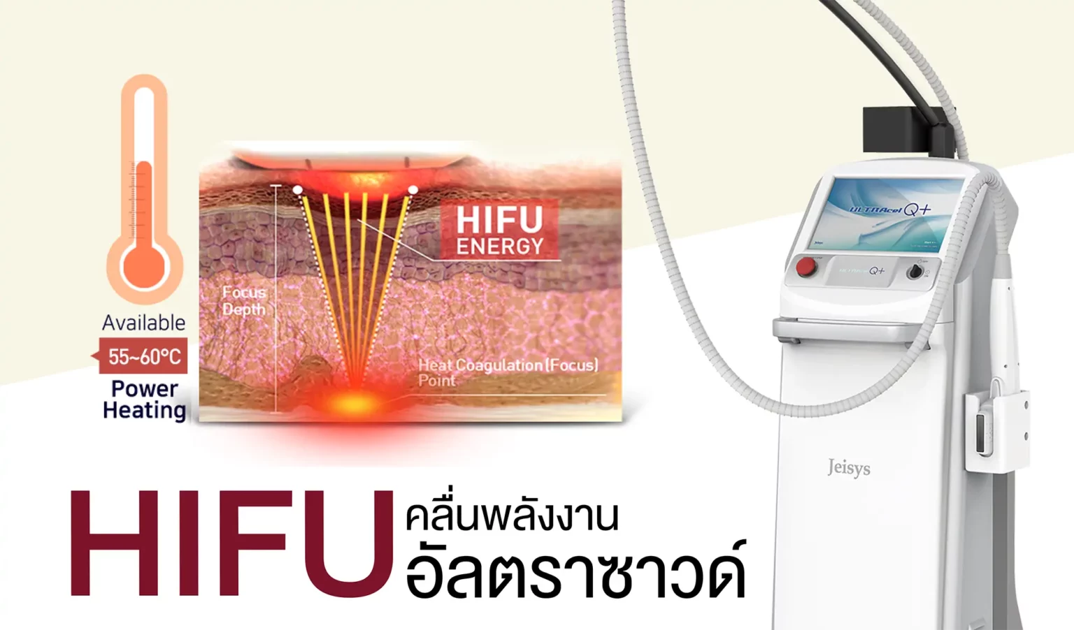 hifu