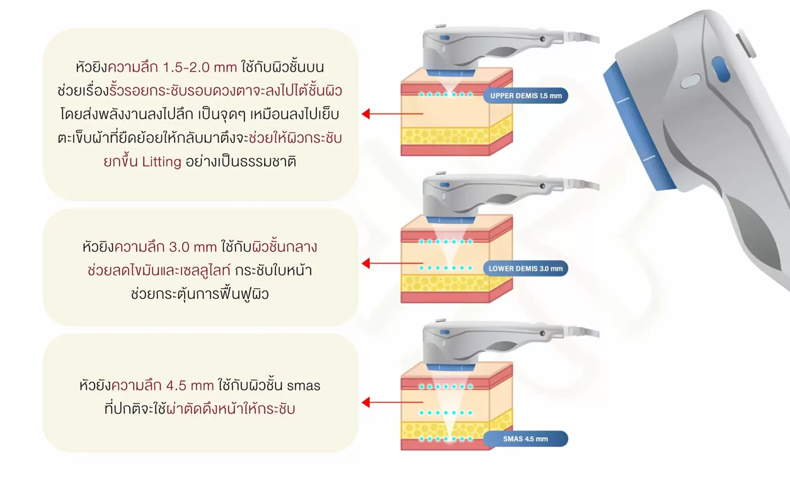 หัวยิงความลึก
