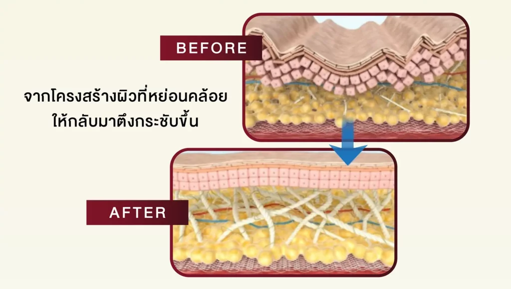 before-after