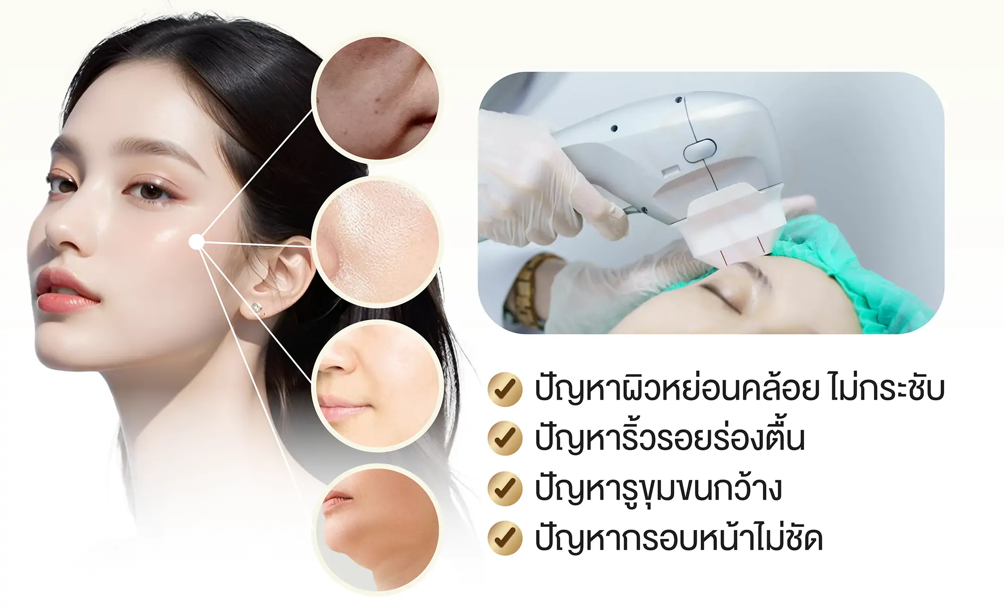 hifu ช่วยเรื่องอะไรบ้าง
